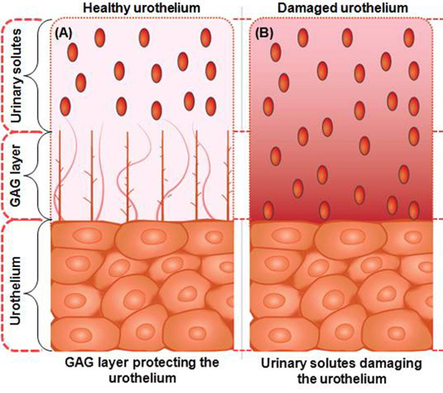 bladder wall layers with and without the glycosaminoglycan layer (gag layer) - science behind treating menopause bladder